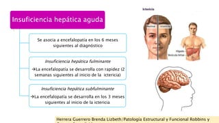 Insuficiencia hepática aguda 
Se asocia a encefalopatía en los 6 meses 
siguientes al diagnóstico 
Insuficiencia hepática ...