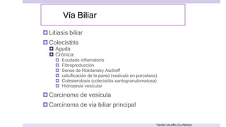 Trastornos de la vesícula biliar 
Litiasis Biliar 
Yedid Murillo Gutiérrez 
 