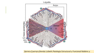 Herrera Guerrero Brenda Lizbeth/Patología Estructural y Funcional Robbins y 
Cotran, 8va edición 
 