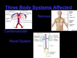 Three Body Systems Affected Nervous Cardiovascular Renal System