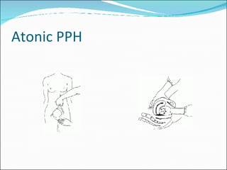 High Risk Pregnancy And Labour final | PPT