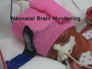 Neonatal Brain Monitoring
 