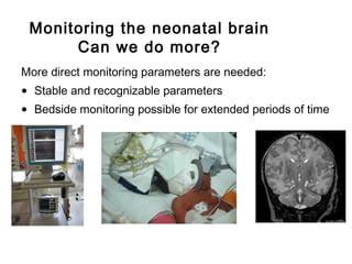 More direct monitoring parameters are needed:
• Stable and recognizable parameters
• Bedside monitoring possible for extended periods of time
Monitoring the neonatal brain
Can we do more?
 