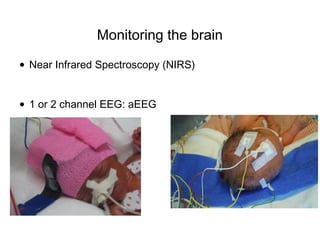 Monitoring the brain
• Near Infrared Spectroscopy (NIRS)
• 1 or 2 channel EEG: aEEG
 