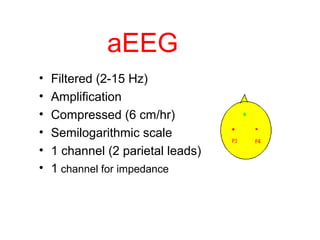aEEG
• Filtered (2-15 Hz)
• Amplification
• Compressed (6 cm/hr)
• Semilogarithmic scale
• 1 channel (2 parietal leads)
• 1 channel for impedance
 