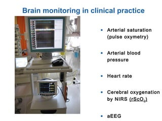 • Arterial saturation
(pulse oxymetry)
• Arterial blood
pressure
• Heart rate
• Cerebral oxygenation
by NIRS (rScO2)
• aEEG
Brain monitoring in clinical practice
 
