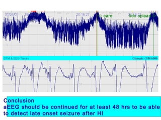Conclusion
aEEG should be continued for at least 48 hrs to be able
to detect late onset seizure after HI
 