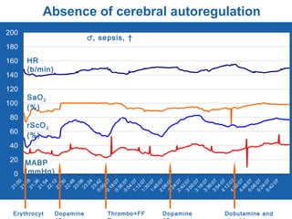 0
20
40
60
80
100
120
140
160
180
200
21:0021:1821:3621:5422:1222:3022:4823:0623:2423:420:00:070:18:070:36:070:54:071:12:071:30:071:48:072:06:072:24:072:42:073:00:073:18:073:36:073:54:074:12:074:30:074:48:075:06:075:24:075:42:07
Erythrocyt Thrombo+FF Dopamine Dobutamine andDopamine
♂, sepsis, †
Absence of cerebral autoregulation
SaO2
(%)
rScO2
(%)
MABP
(mmHg)
HR
(b/min)
 