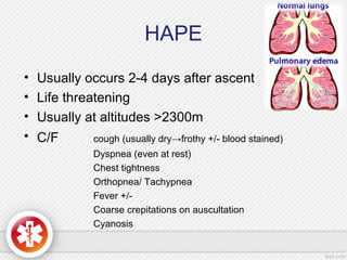 HAPE
• Usually occurs 2-4 days after ascent
• Life threatening
• Usually at altitudes >2300m
• C/F cough (usually dry→frothy +/- blood stained)
Dyspnea (even at rest)
Chest tightness
Orthopnea/ Tachypnea
Fever +/-
Coarse crepitations on auscultation
Cyanosis
 