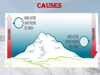 CAUSES
 
