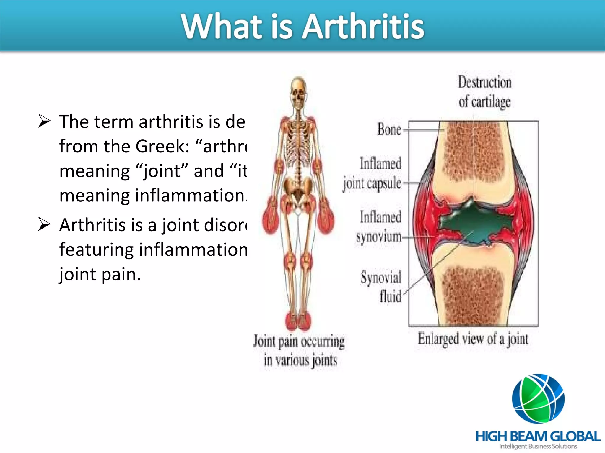 Arthritis | PPT