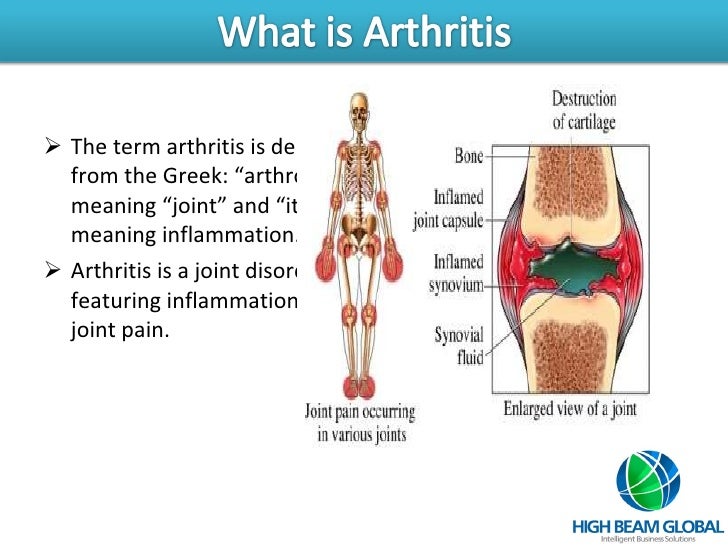 Arthritis