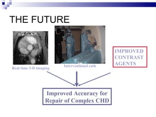 THE FUTURE Improved Accuracy for Repair of Complex CHD Real time 3-D imaging Interventional cath IMPROVED CONTRAST AGENTS 