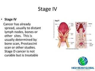 Stage IV Stage IV  Cancer has already spread, usually to distant lymph nodes, bones or other  sites.  This is usually determined by bone scan, Prostascint scan or other studies. Stage D cancer is not curable but is treatable  