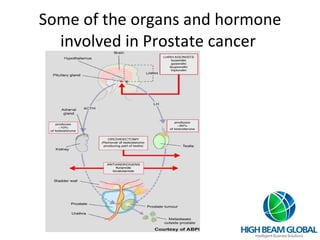Some of the organs and hormone involved in Prostate cancer  