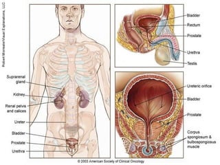 Prostate Cancer