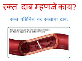 रक्त दाब म्हणजे 
काय? 
रक्त वहहनिि वर रक्ताचा दाब. 
 