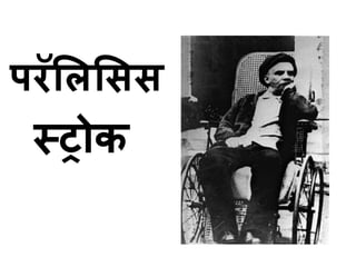 परॅलललसस 
स्रोक 
 