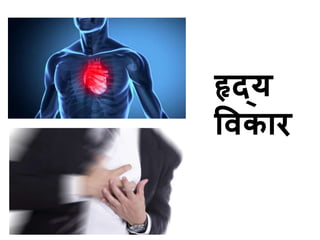 हृद्य 
ववकार 
 