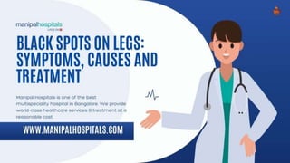 Black Spots on Legs: Symptoms, Causes and Treatment.pptx
