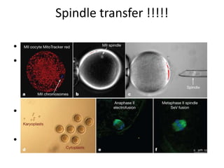 Spindle transfer !!!!!
• spindle-chromosomal complex transfer
• taking nuclear DNA from an egg cell and
transferring that DNA into another egg cell,
leaving the defective mitochondrial DNA
behind
• For genetic disease
• Safety?????? Gene therapy
 