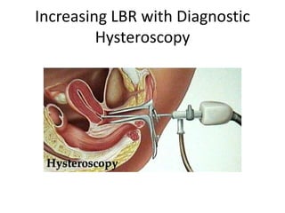 Increasing LBR with Diagnostic
Hysteroscopy
 