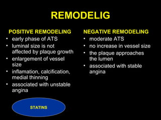 REMODELIG
POSITIVE REMODELING
• early phase of ATS
• luminal size is not
affected by plaque growth
• enlargement of vessel
size
• inflamation, calcification,
medial thinning
• associated with unstable
angina
NEGATIVE REMODELING
• moderate ATS
• no increase in vessel size
• the plaque approaches
the lumen
• associated with stable
angina
STATINS
 