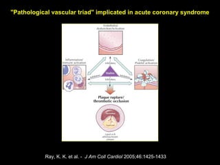 Ray, K. K. et al. - J Am Coll Cardiol 2005;46:1425-1433
"Pathological vascular triad" implicated in acute coronary syndrome
 