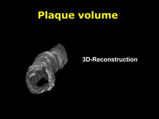 Plaque volume
3D-Reconstruction
 