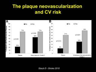 The plaque neovascularization
and CV risk
Staub D - Stroke 2010
 