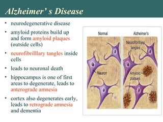 Alzheimer’ s Disease
• neurodegenerative disease
• amyloid proteins build up
and form amyloid plaques
(outside cells)
• neurofibrilllary tangles inside
cells
• leads to neuronal death
• hippocampus is one of first
areas to degenerate, leads to
anterograde amnesia
• cortex also degenerates early,
leads to retrograde amnesia
and dementia
 