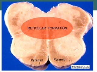 RETICULAR FORMATION
MID MEDULLA
PyramidPyramid
 
