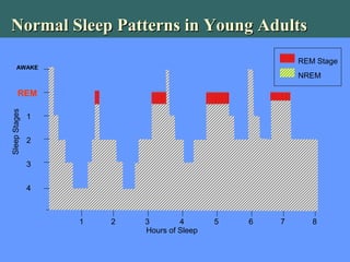 1 2 3 4 5 6 7 8
4
3
2
1
REM
AWAKE
SleepStages
Hours of Sleep
REM Stage
NREM
Normal Sleep Patterns in Young AdultsNormal Sleep Patterns in Young Adults
 