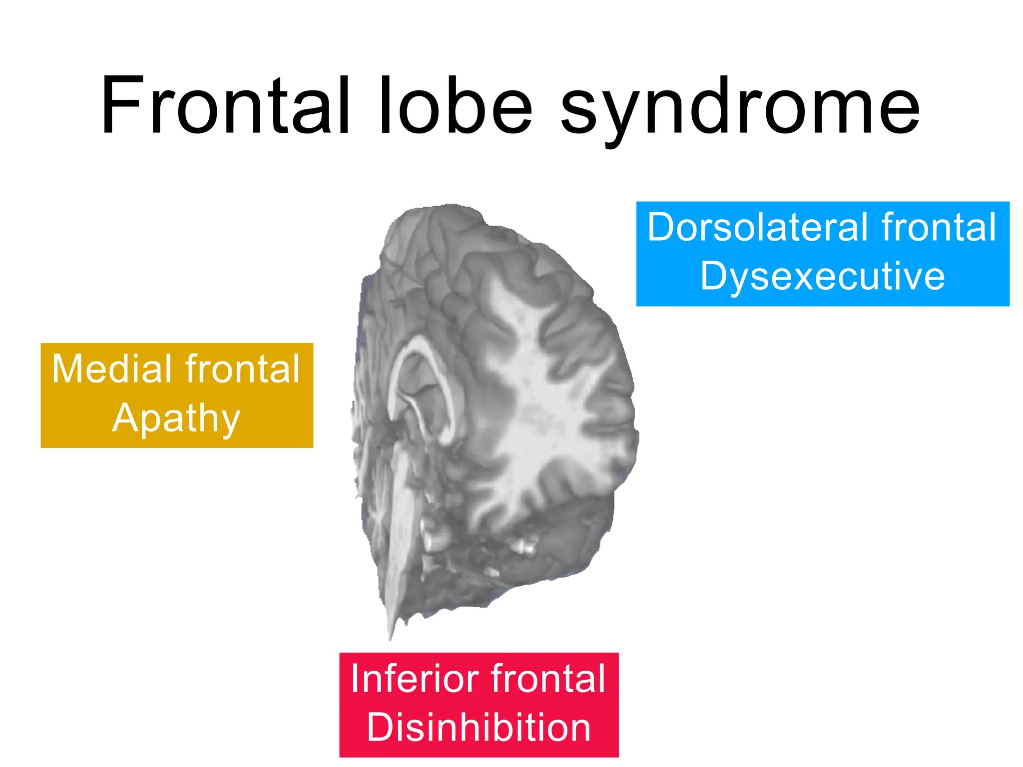Higher Cortical Functions Examination 4may2020.pptx