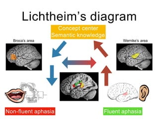 Lichtheim’s diagram
Broca’s area Wernike’s area
Concept center
Semantic knowledge
Fluent aphasia
Non-fluent aphasia
 