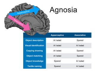 Agnosia
Apperceptive Associative
Object description Affected Spared
Visual identification Affected Affected
Copying drawing Affected Spared
Object matching Affected Spared
Object knowledge Spared Affected
Tactile naming Spared Affected
 