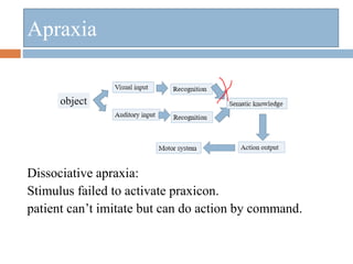 Dissociative apraxia:
Stimulus failed to activate praxicon.
patient can’t imitate but can do action by command.
Apraxia
 