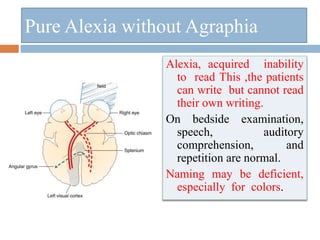 Pure Alexia without Agraphia
Alexia, acquired inability
to read This ,the patients
can write but cannot read
their own writing.
On bedside examination,
speech, auditory
comprehension, and
repetition are normal.
Naming may be deficient,
especially for colors.
 