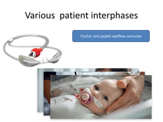 Various patient interphases
Fischer and paykel optiflow cannulae
 