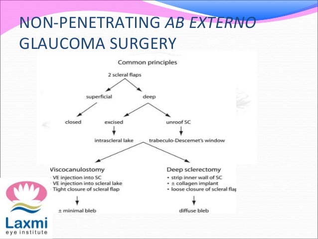 High Frequency Deep Sclerotomy Hfds