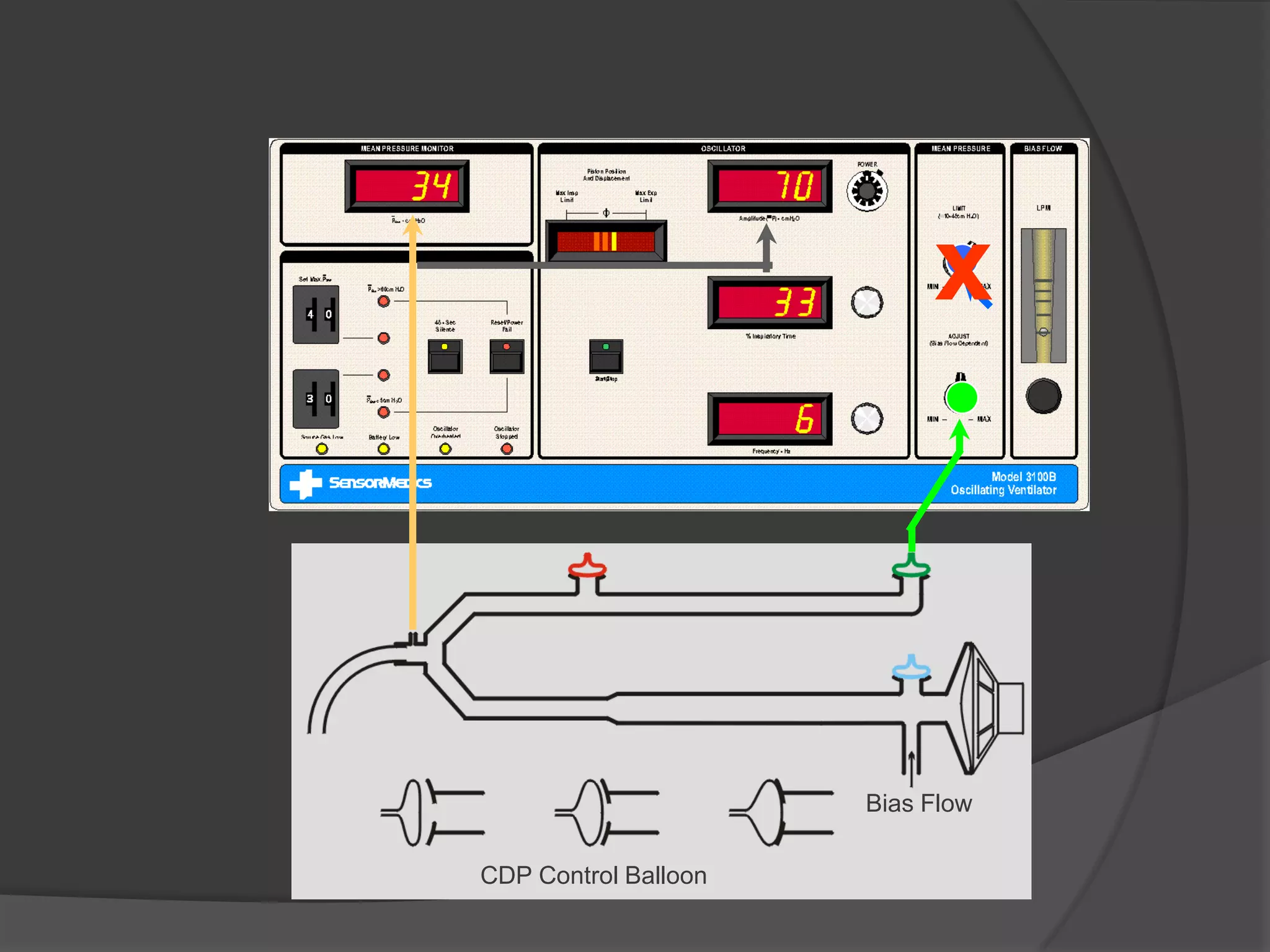 High Frequency Oscillatory Ventilation PPT
