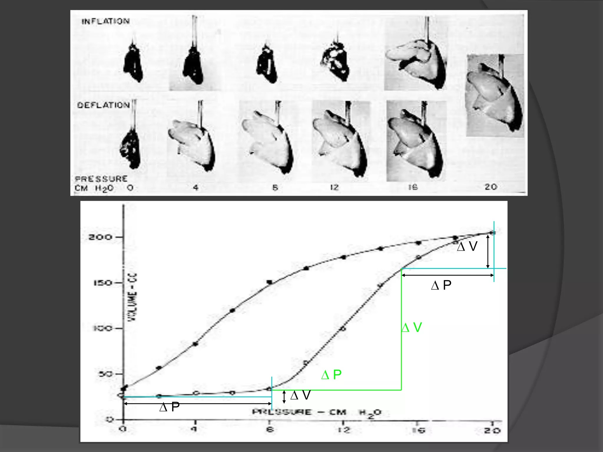  V P V P V P