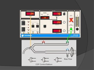 xBias FlowCDP Control Balloon