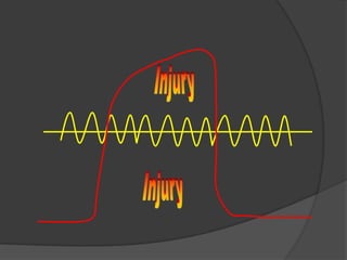 InjuryInjury