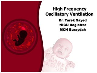 High Frequency
Oscillatory Ventilation
Dr. Tarek Sayed
NICU Registrar
MCH Buraydah

 