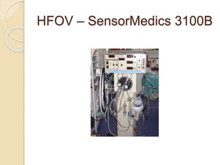 HFOV – SensorMedics 3100B
 