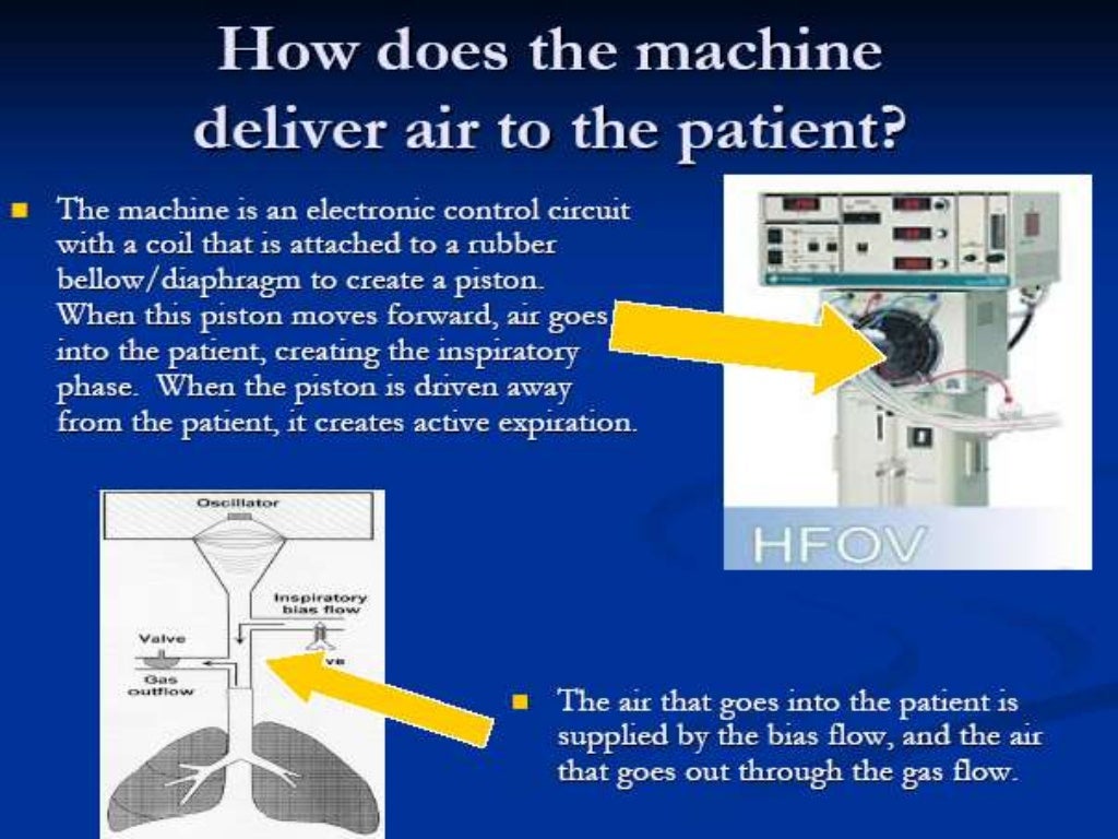  high frequency oscillatory ventilation 
