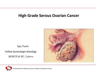 Shaukat Khanum Memorial Cancer Hospital and Research Centre
Iqra Yasin
High Grade Serous Ovarian Cancer
Fellow Gynecologic Oncology
SKMCH & RC, Lahore
 