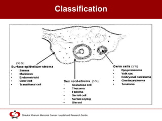 High Grade Serous Ovarian Cancer | PPTX