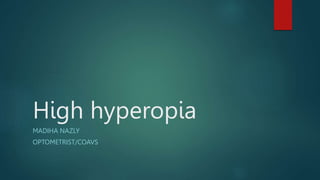 High hyperopia
MADIHA NAZLY
OPTOMETRIST/COAVS
 